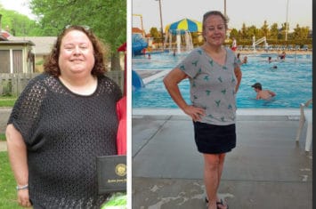 gastric sleeve success stories 2022