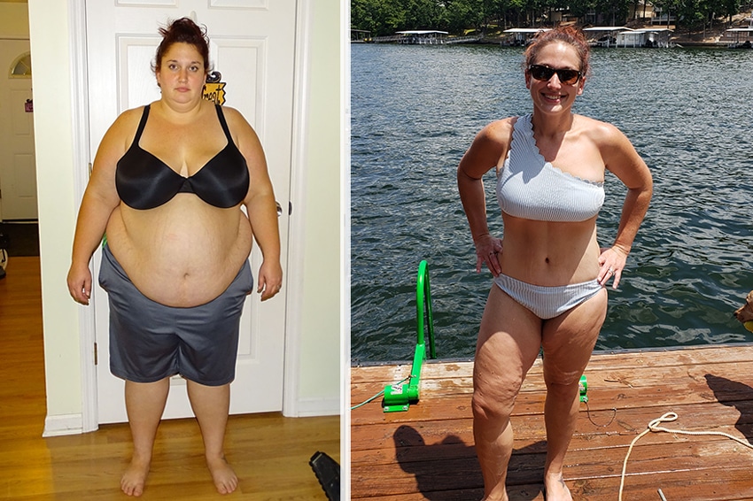 Gastric Bypass success story Stephanie lost 148 lbs! 