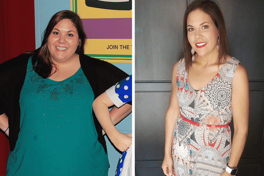 I Had Gastric Sleeve Surgery to Lose 150 Pounds - Weight Loss